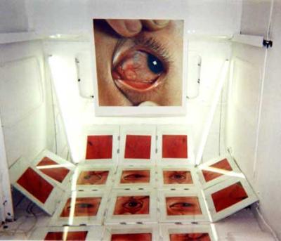 docu.old2.eye am hurt docu.old2.eye am hurt