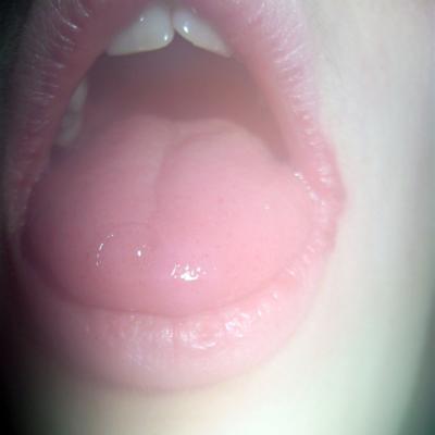saliva - 01 saliva - 01