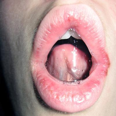 saliva - 03 saliva - 03