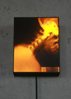 X-Ray Portraits X-Ray Portraits